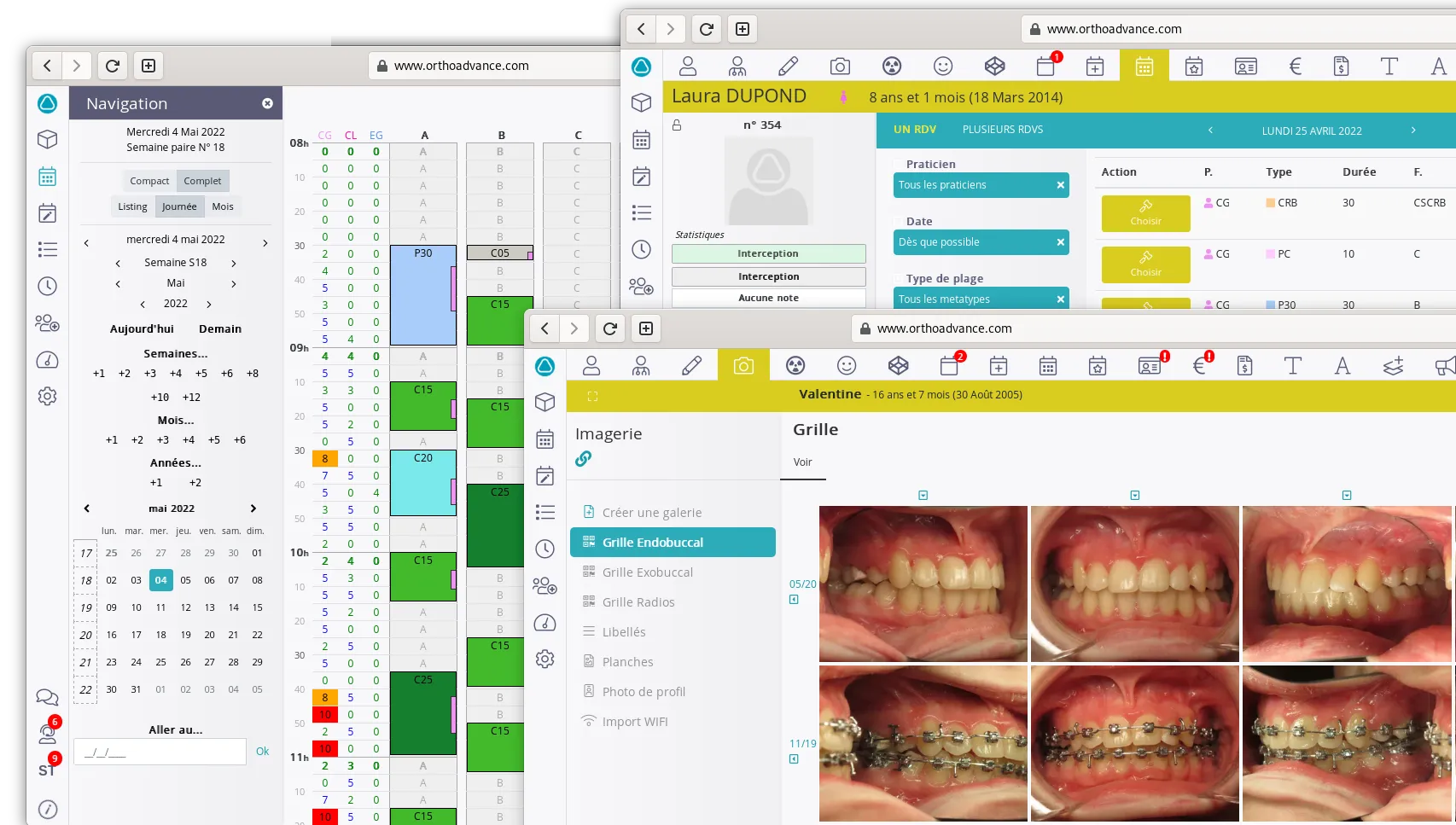 Interface d'OrthoADVANCE : planning, fiche patient et imagerie